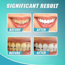 Load image into Gallery viewer, 【LAST DAY PROMOTION】 - INTENSIVE STAIN REMOVAL WHITENING TOOTHPASTE
