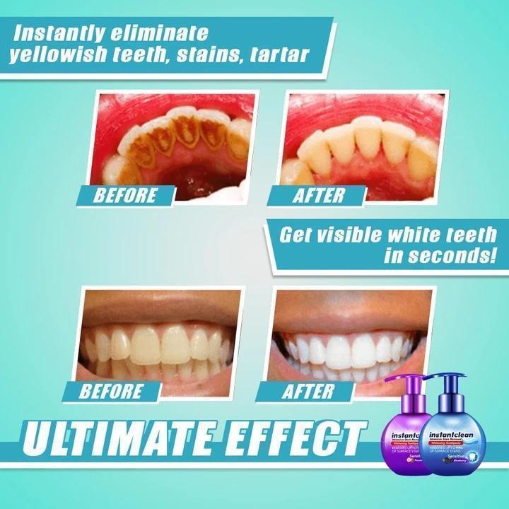 【LAST DAY PROMOTION】 - Intensive Stain Removal Teeth Whitening Toothpaste
