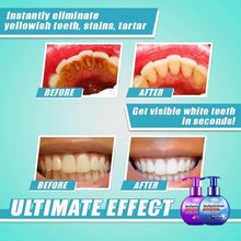 Load image into Gallery viewer, 【LAST DAY PROMOTION】 - INTENSIVE STAIN REMOVAL WHITENING TOOTHPASTE
