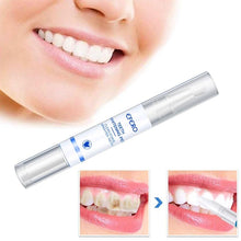 Load image into Gallery viewer, Billionaire White® Teeth Whitening Pen
