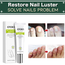 Load image into Gallery viewer, Nail Fungus Treatment Gel
