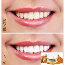 Load image into Gallery viewer, ModernMint™ Turmeric Teeth Whitening Powder 【LIMITED TIME 65% OFF SALE】
